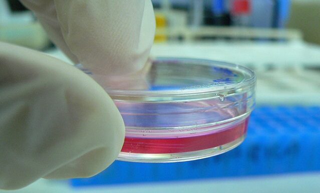 Ciencia y Tecnología Utilizan microondas y ensayan una terapia localizada para atacar tumores Ensayo de laboratorio con una técnica para eliminar tumores