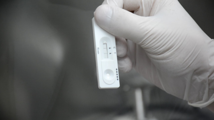 Desarrollan prueba molecular portátil para detectar una micosis endémica del norte argentino